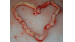 Illustration for article titled 'Birth Art': The Most Horrifying Trend Ever